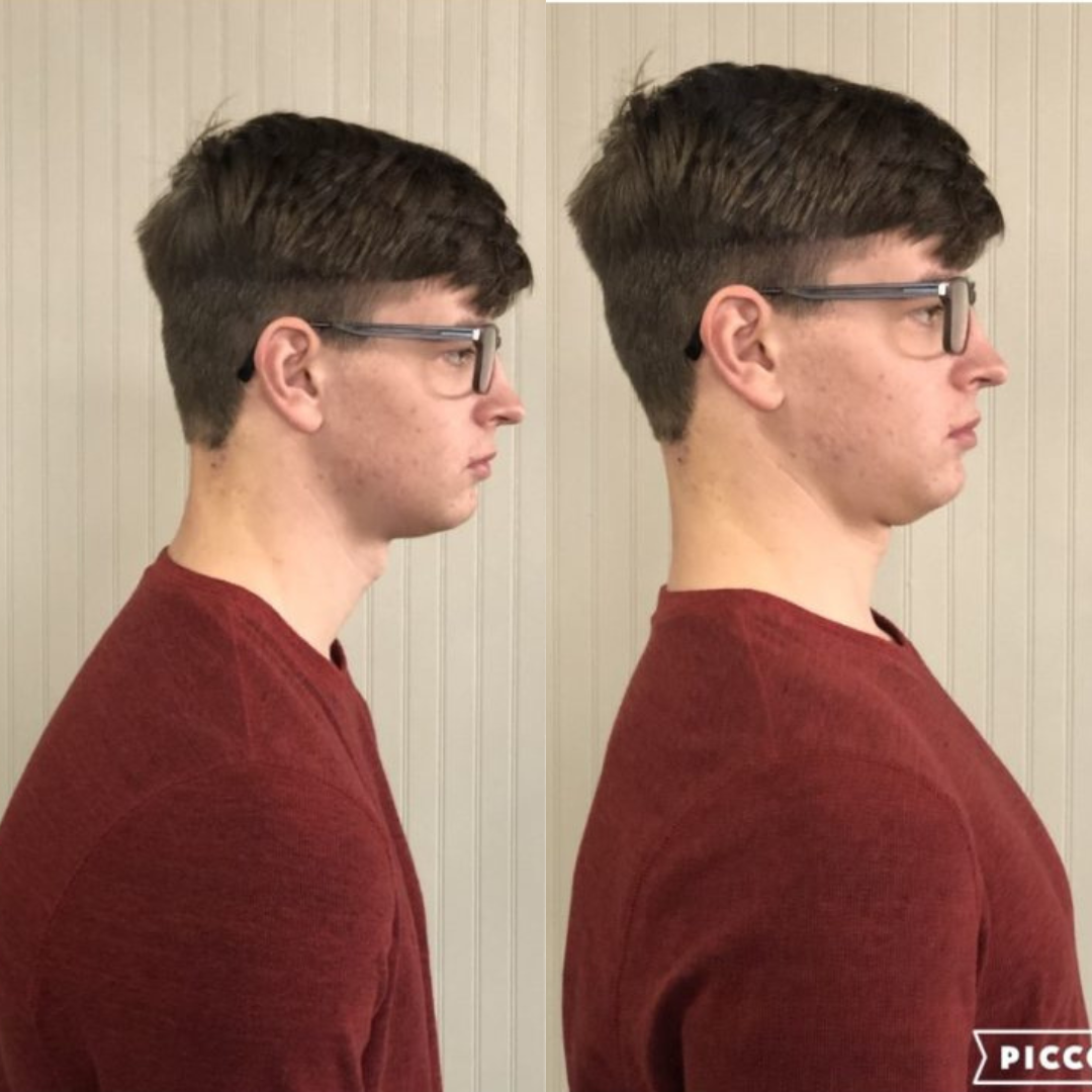 ErgoFlex Nyak- és Gerincnyújtó Tartásjavító Párna