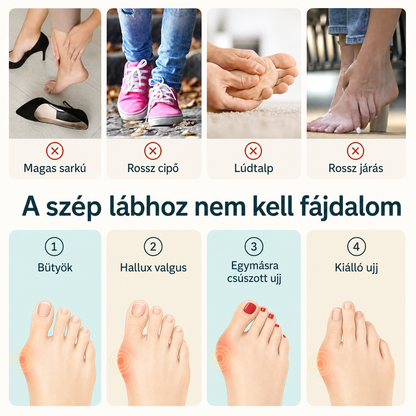 A bütyök okai és típusai rajzokkal