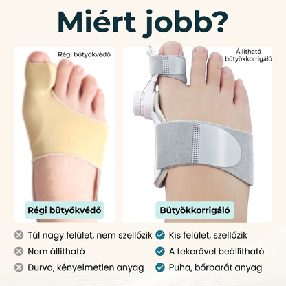Régi bütyökvédő és az állítható bütyökkorrigáló összehasonlítása
